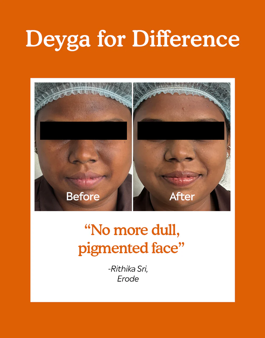 10% Vitamin C Face Serum - Image 4